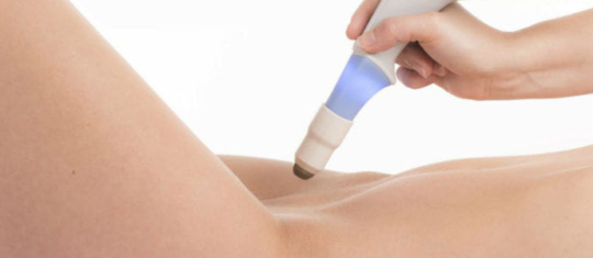 laser vaginal