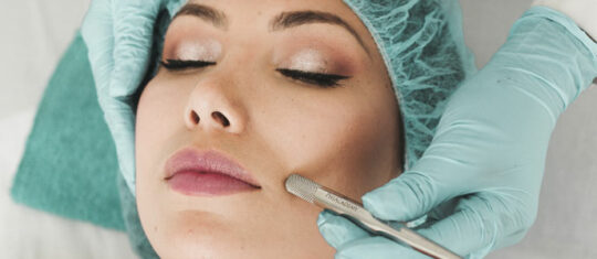 peeling moyen